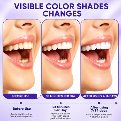 Solu Teeth Whitening Strips