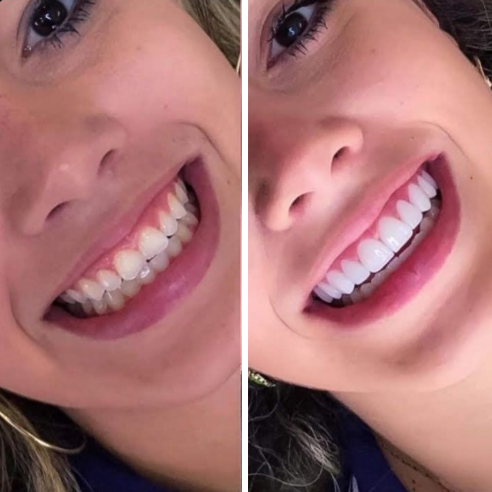 <h2>Real People. Real Results. Real Smiles.</h2>