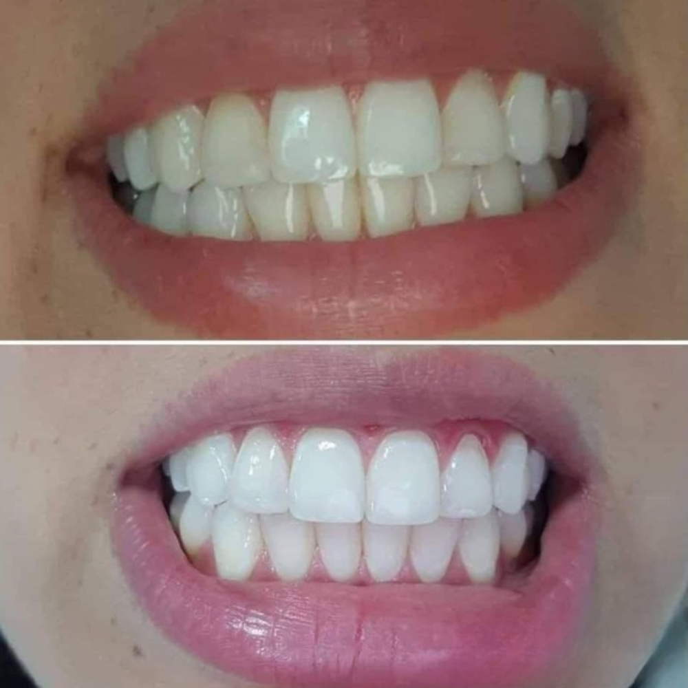 <h2>Real People. Real Results. Real Smiles.</h2>