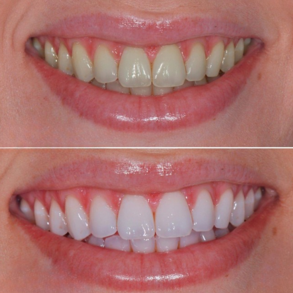 <h2>Real People. Real Results. Real Smiles.</h2>