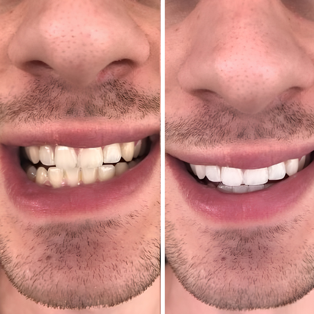 <h2>Real People. Real Results. Real Smiles.</h2>