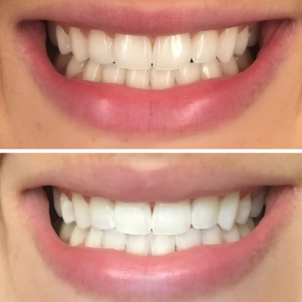 <h2>Real People. Real Results. Real Smiles.</h2>